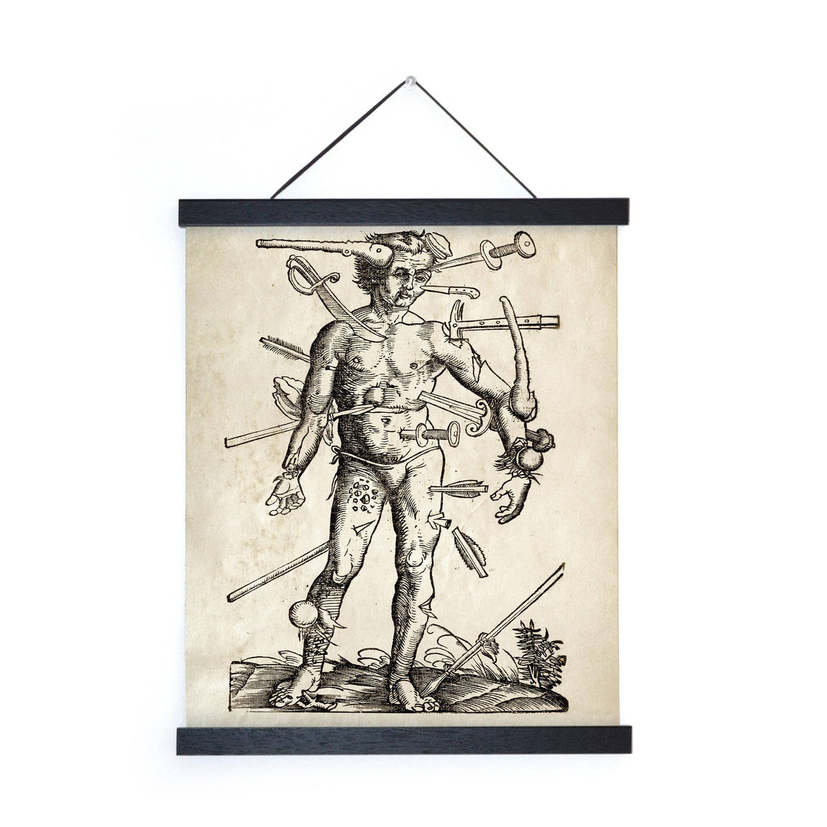 Vintage Anatomy Wounded Man Print
