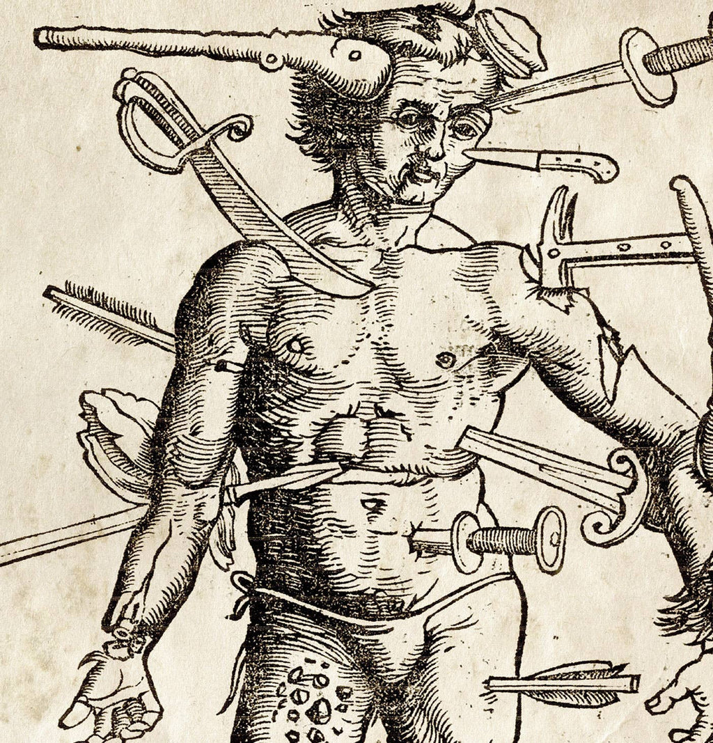 Vintage Anatomy Wounded Man Print