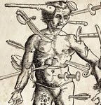 Vintage Anatomy Wounded Man Print