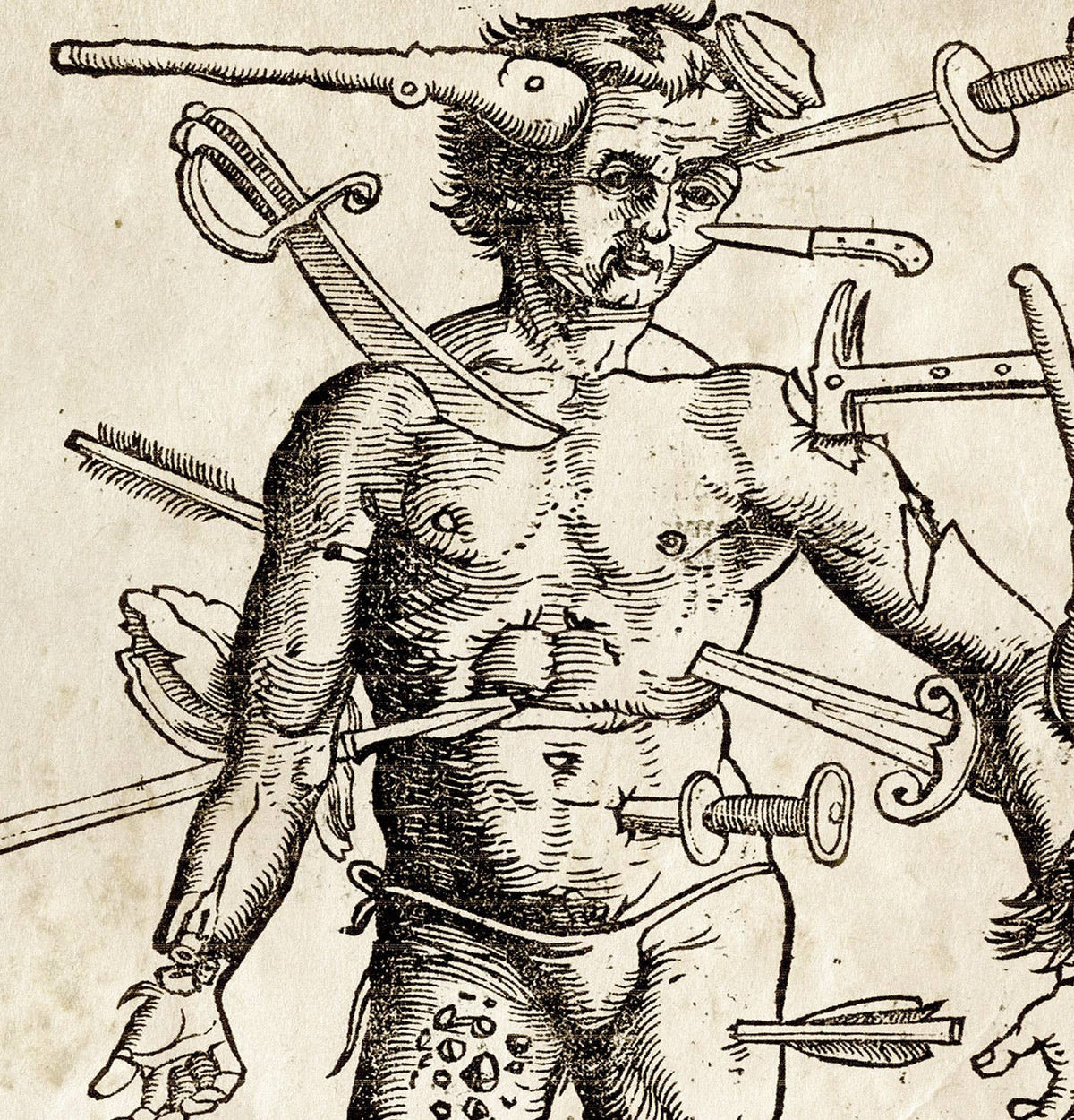 Vintage Anatomy Wounded Man Print