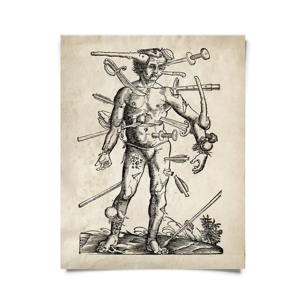 Vintage Anatomy Wounded Man Print